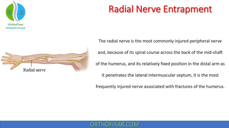 Radial Nerve Entrapment