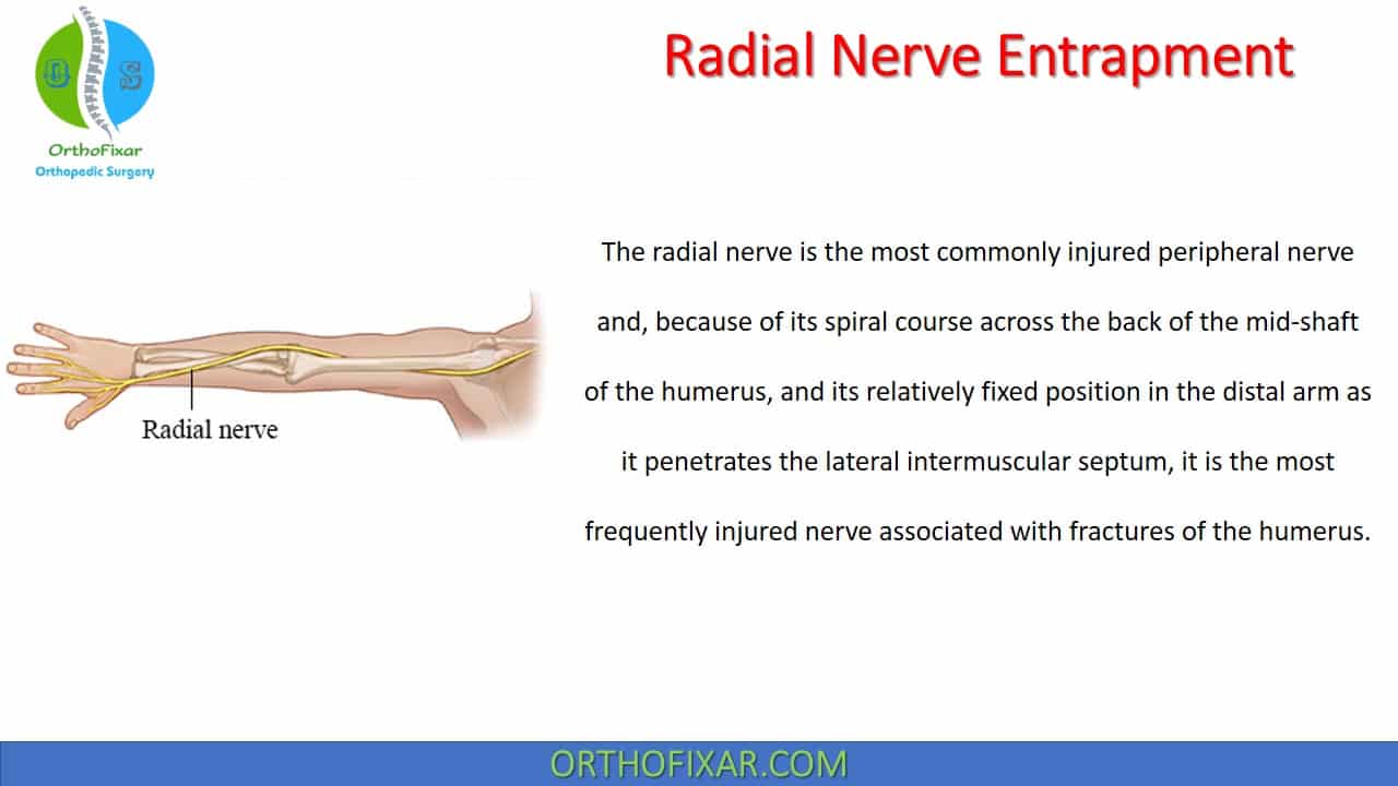 radial nerve injury