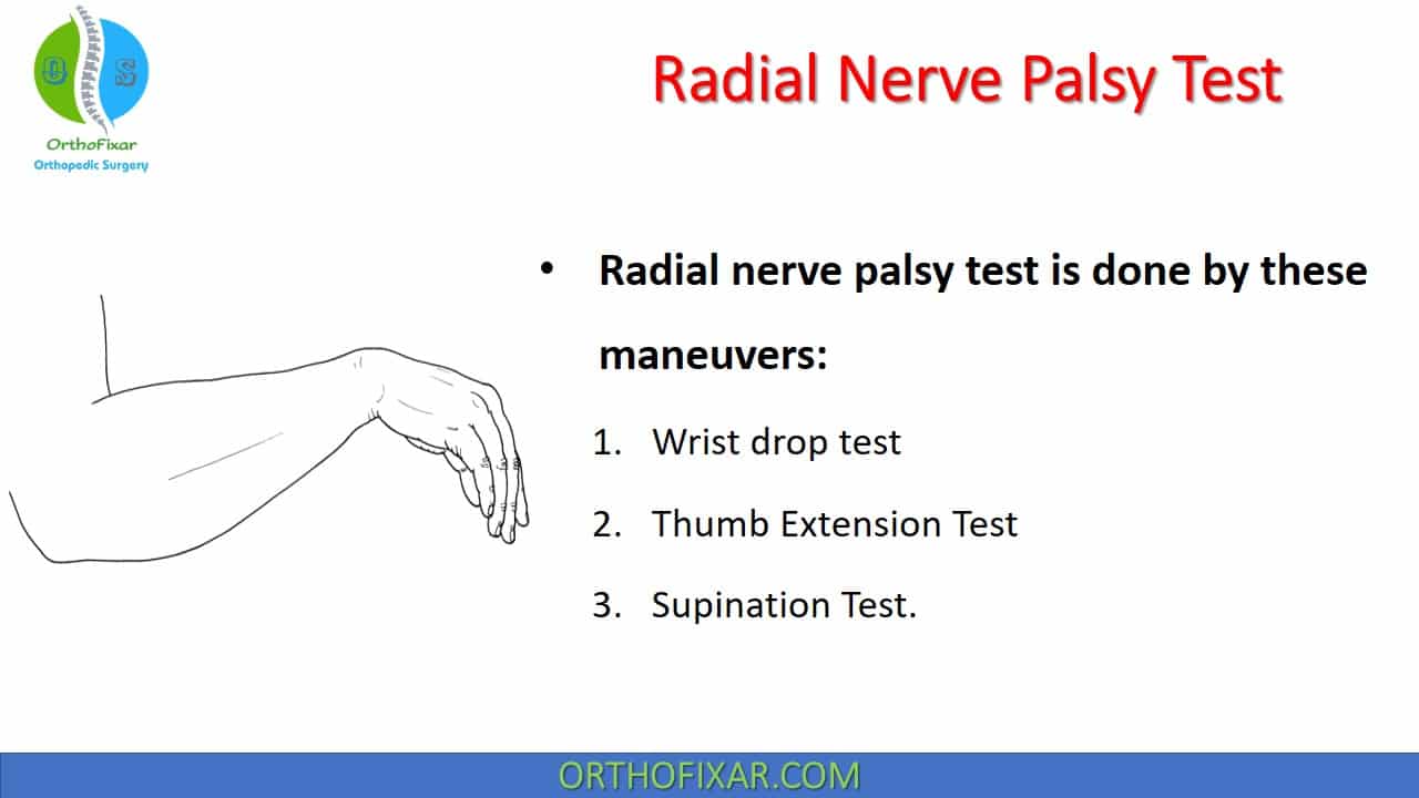  Radial Nerve Palsy Test 