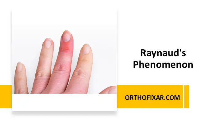 Raynaud's Phenomenon