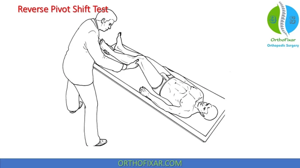 Reverse Pivot Shift Test