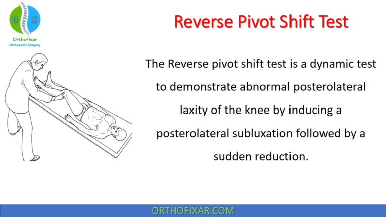 Reverse Pivot Shift Test
