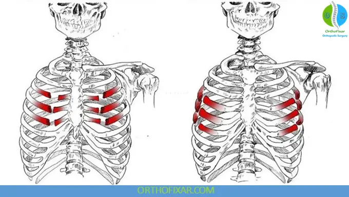 Rib fractures and flail chest