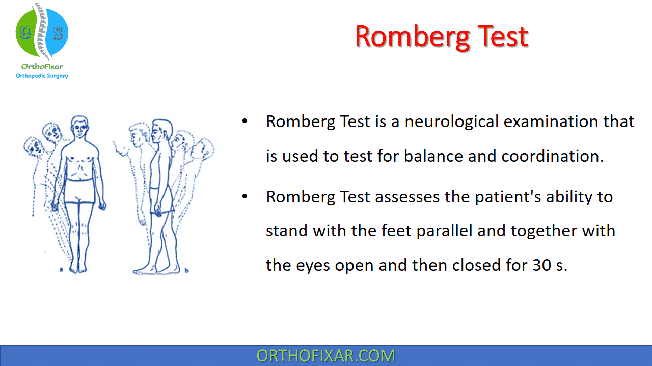  Romberg Test 