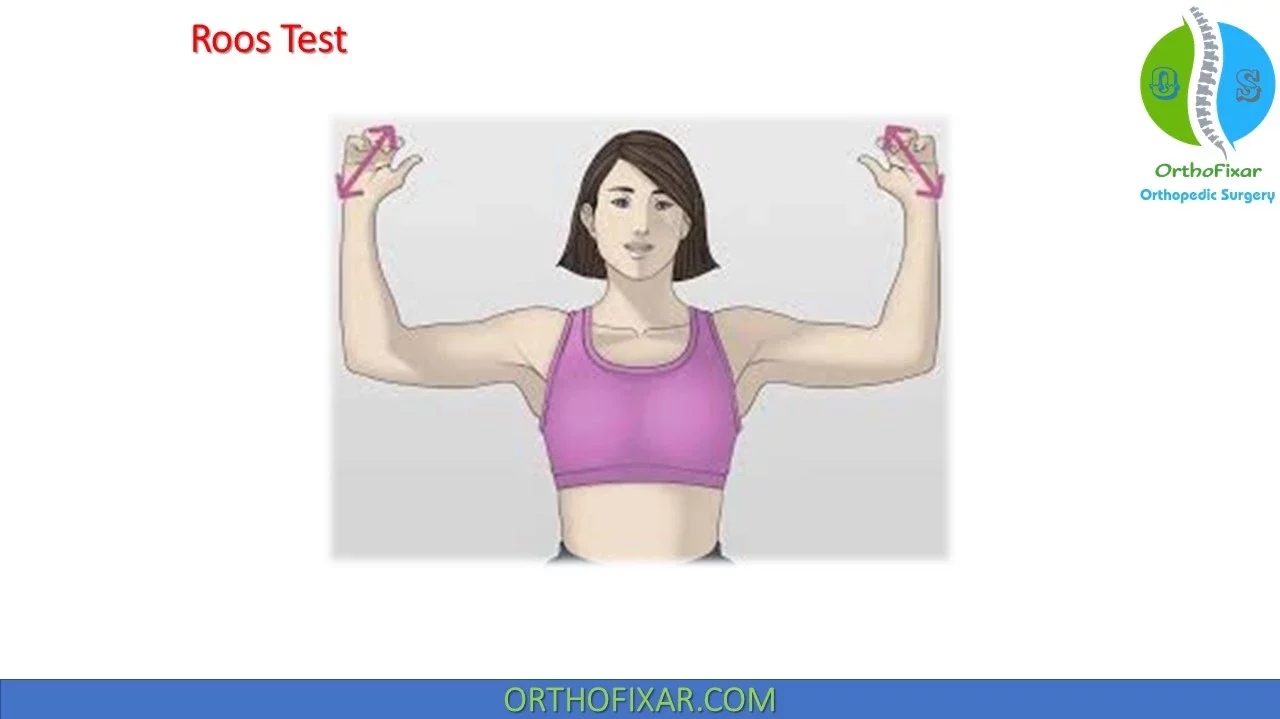 Roos Test | Elevated Arm Stress Test | OrthoFixar 2025