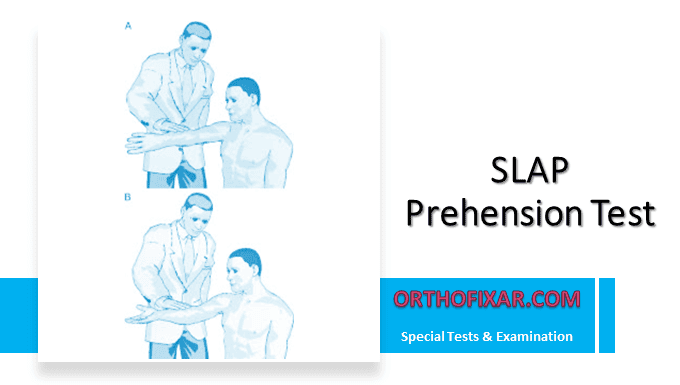 SLAP Prehension Test | OrthoFixar 2025