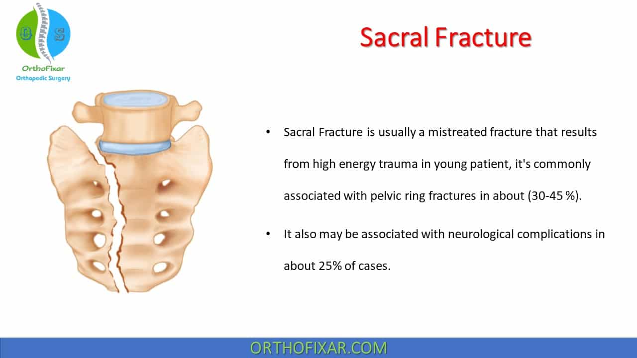 closed fracture of sacrum