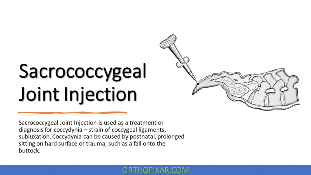 Sacrococcygeal Joint Injection | OrthoFixar 2024