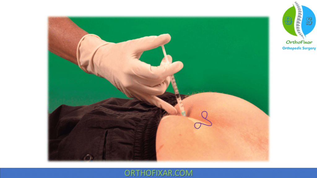 Sacrococcygeal Joint Injection Technique