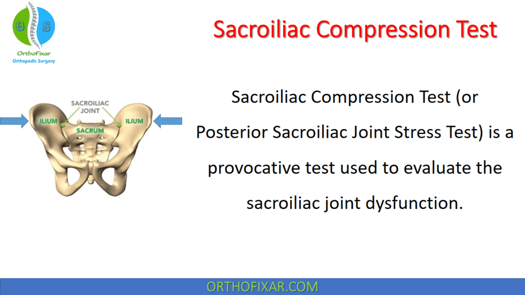 Sacroiliac Compression Test | OrthoFixar 2024