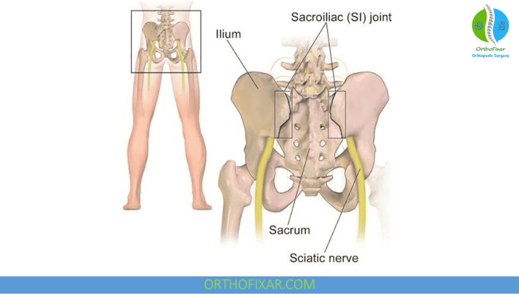 Sacroiliac Joint Dysfunction