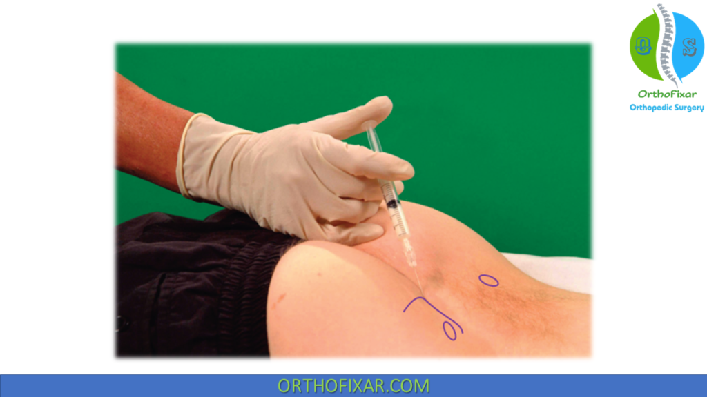 Sacroiliac Joint Injection Technique