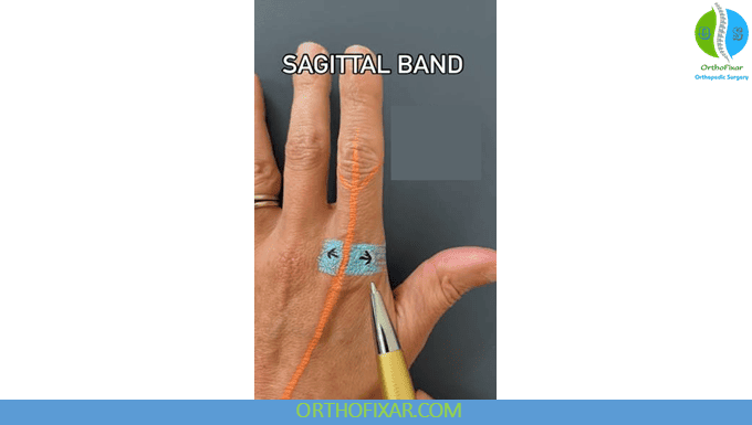 Sagittal Band Injury: Boxer’s Knuckle Symptoms & Treatment 6 Sagittal Band