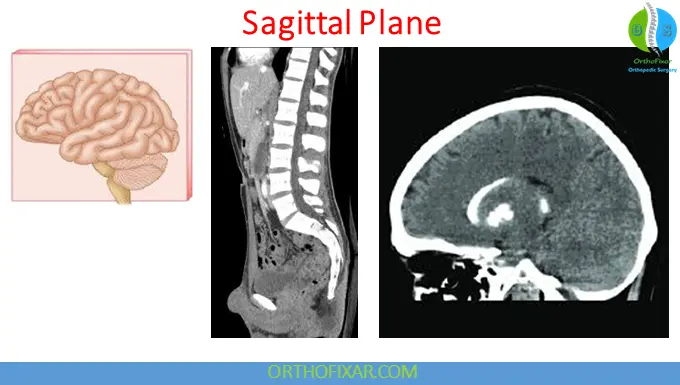 Sagittal Plane