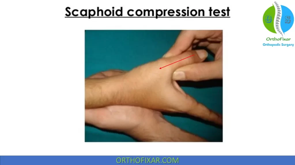 Scaphoid compression test