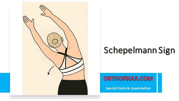 Schepelmann Sign