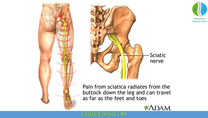 Sciatic Nerve Anatomy 2 Sciatic Nerve pain
