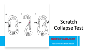 Scratch Collapse Test