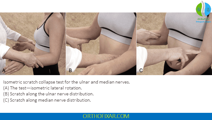 Scratch Collapse Test 3 Scratch Collapse Test for the Ulnar & median nerves
