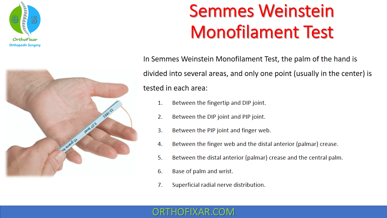 Semmes Weinstein Monofilament Test