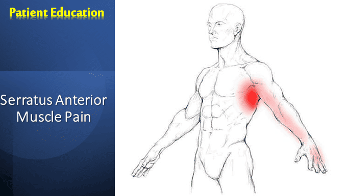 Serratus Anterior Muscle Pain Causes, Symptoms, & Treatment