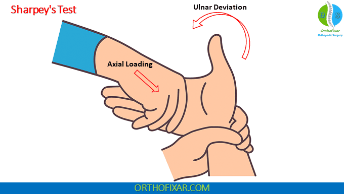 Sharpey's Test For TFCC