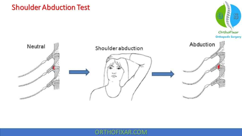Shoulder Abduction Test procedure