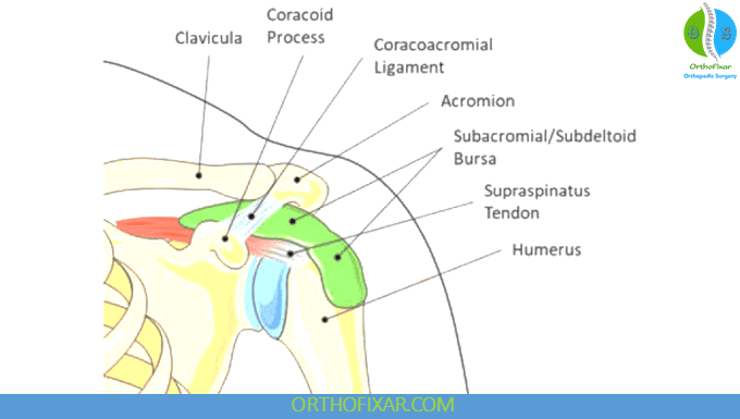 Shoulder Bursitis