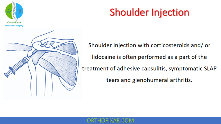 Shoulder Injection
