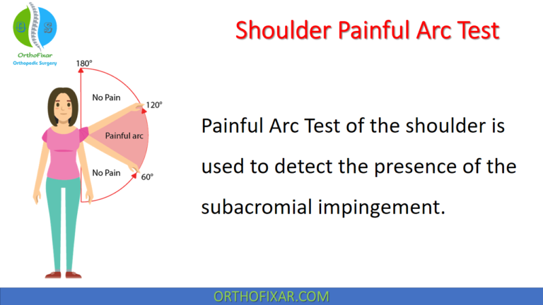 Shoulder Painful Arc Test