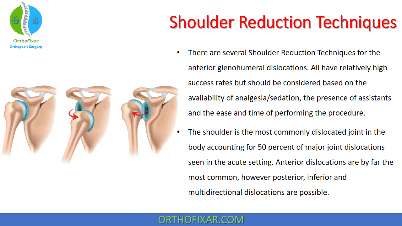  Shoulder Reduction Techniques 