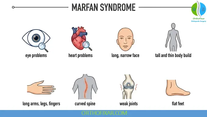 Signs and Symptoms of Marfan Syndrome
