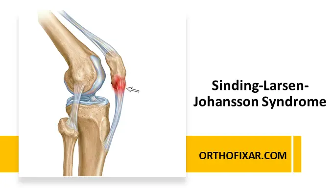 Sinding-Larsen-Johansson Syndrome