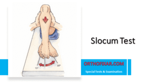 Knee Slocum Test 2 Slocum Test