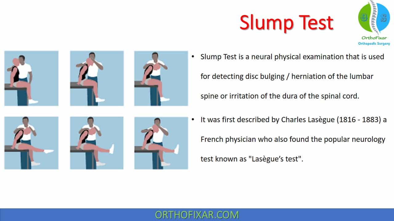  Slump Test for Diagnosing Lumbar Disc Herniation 