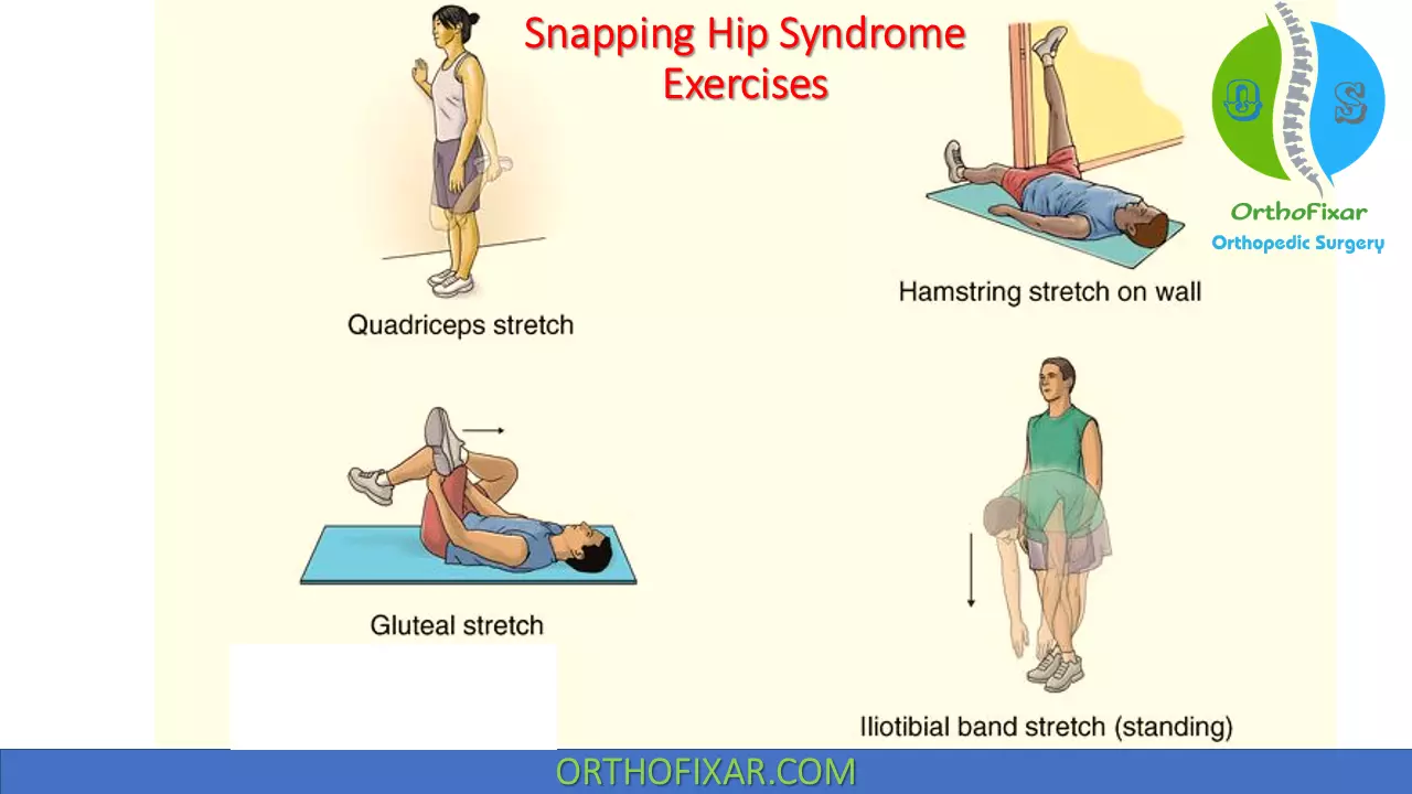 Snapping Hip Syndrome exercises