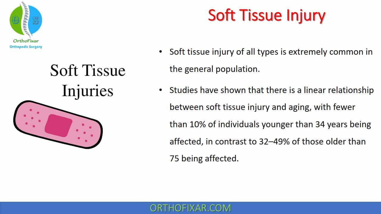 Soft Tissue Injuries: What are They? Types & Treatment, soft tissue ...