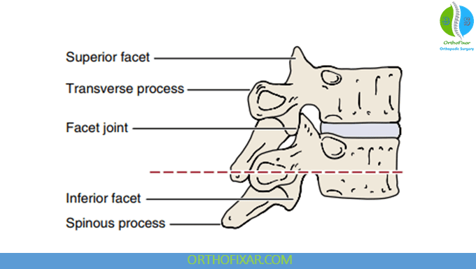 Spinous process of one thoracic vertebra