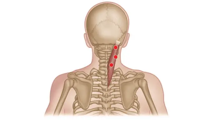 Splenius Capitis Muscle Pain location