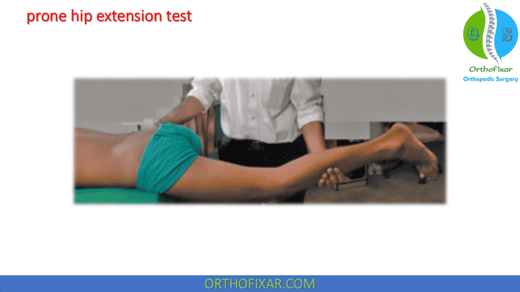 Staheli prone hip extension test (1)