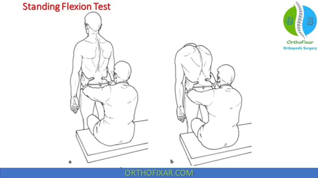 Standing Flexion Test procedure