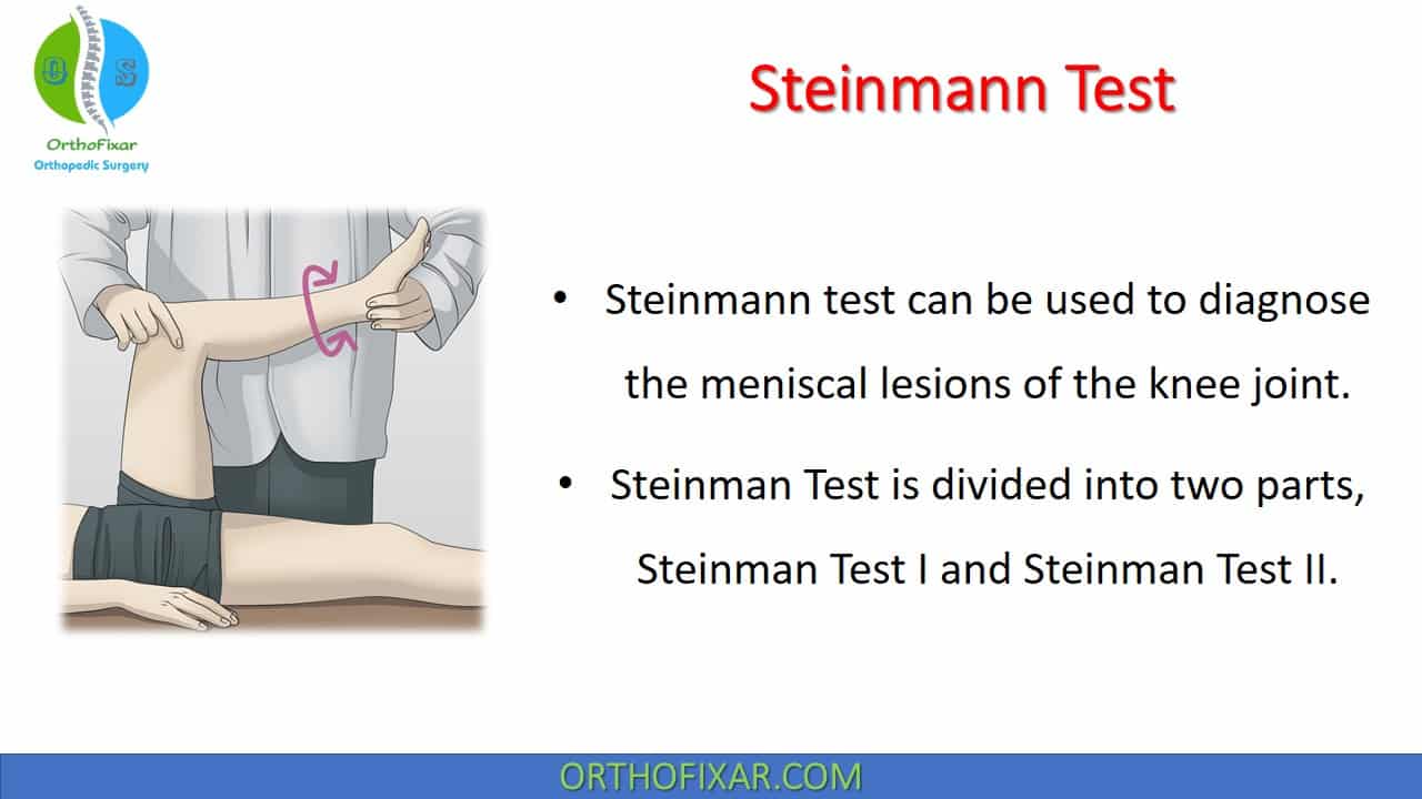  Steinman Test 