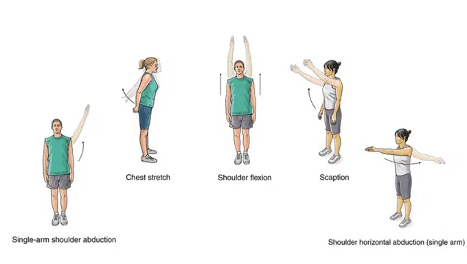 Sternoclavicular Joint Pain: Causes, Symptoms, and Treatment 3 Sternoclavicular joint pain exercises treatment