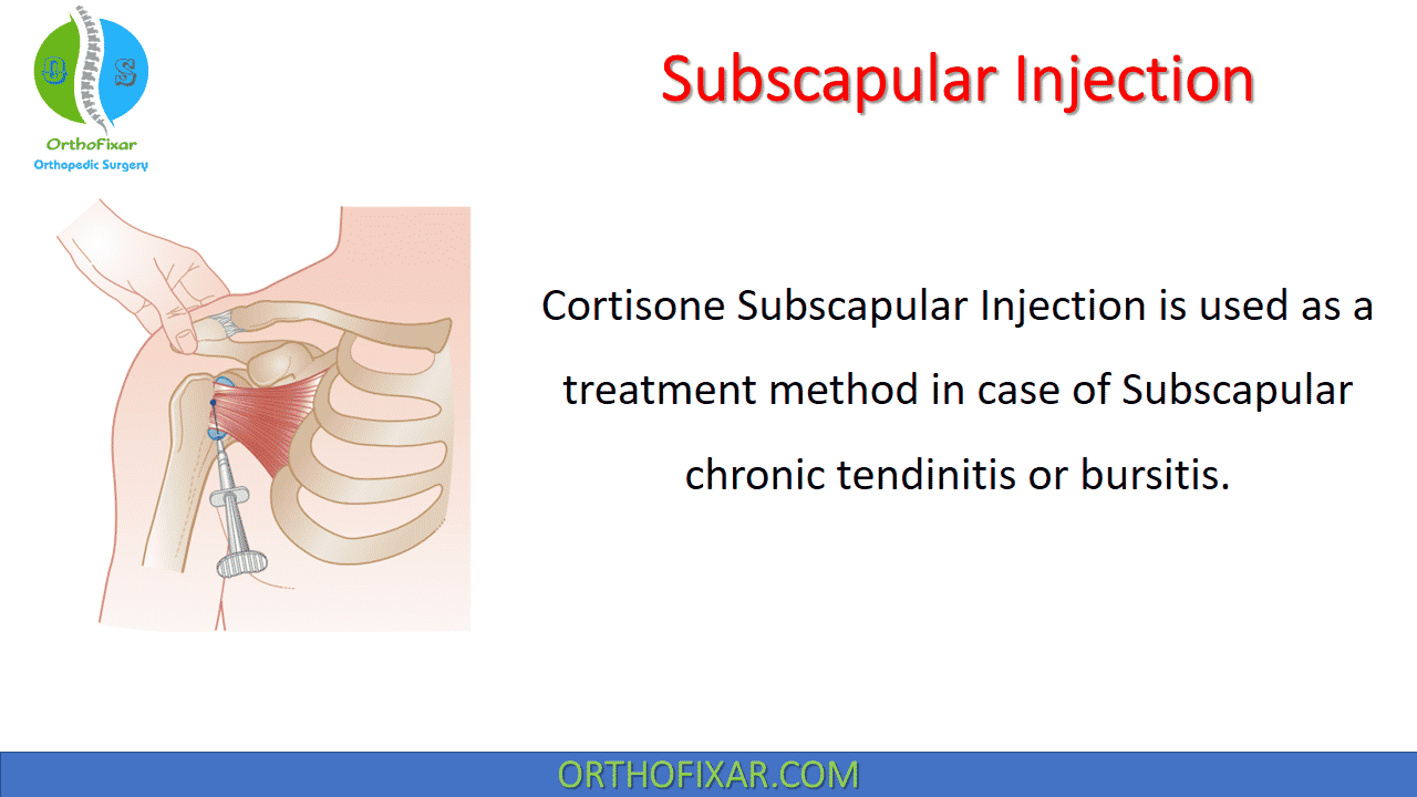 Subscapular Injection