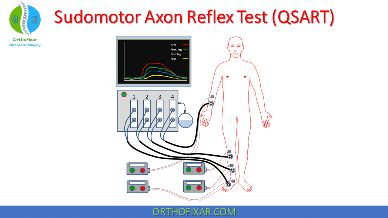 Sudomotor Axon Reflex Test (QSART)