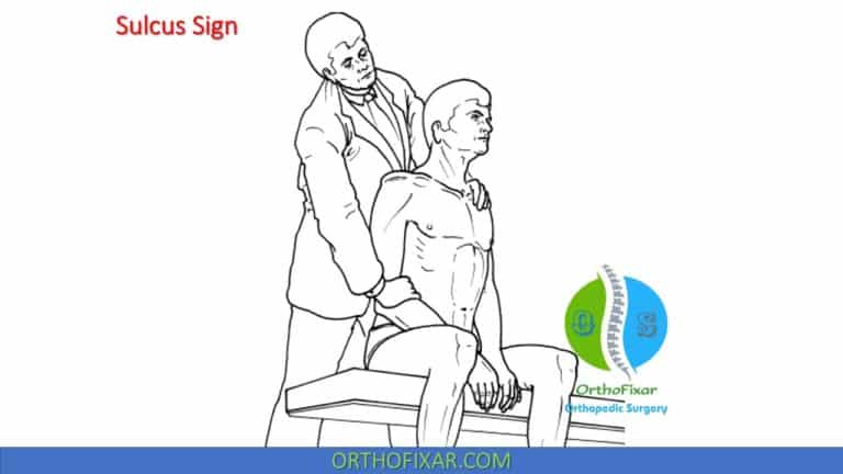 Positive Sulcus Sulcus Sign & Inferior Drawer Test: Shoulder Instability Assessment