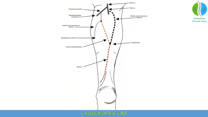 Sural Nerve course