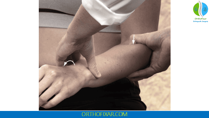 TILT Sign for Partial Tear of Distal Biceps Tendon 2 TILT Sign for Partial Tear of Distal Biceps Tendon