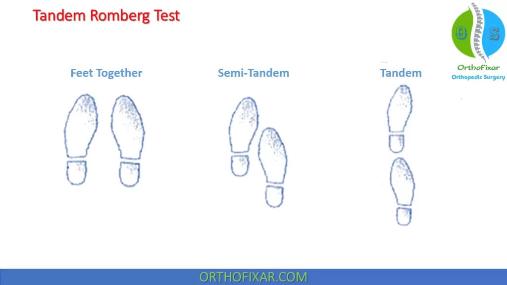 Tandem Romberg Test