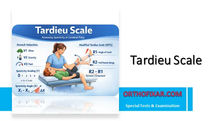 Tardieu Scale